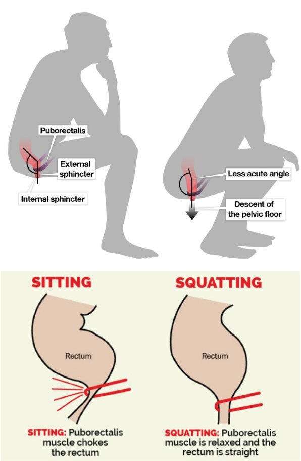 Illustration-of-the-Puborectalis-Muscle-at-the-Sitting-and-Squatting-Positions-Source.jpg