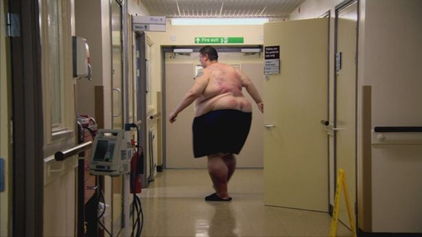 Weight Loss Ward patient Terry.jpeg